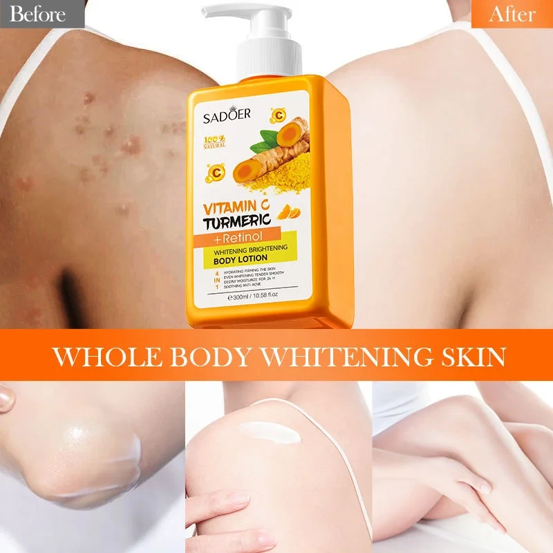 Sadoer Vitamin C Turmeric Body Lotion-300ml