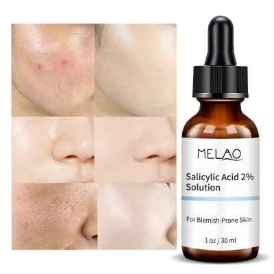 Melao Salicylic Acid 2% Solution – 30 ml